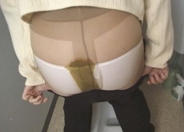 ウンチお漏らし