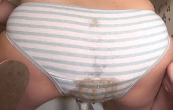 女スカトロマニアが縞パン丸出しでウンチお漏らし